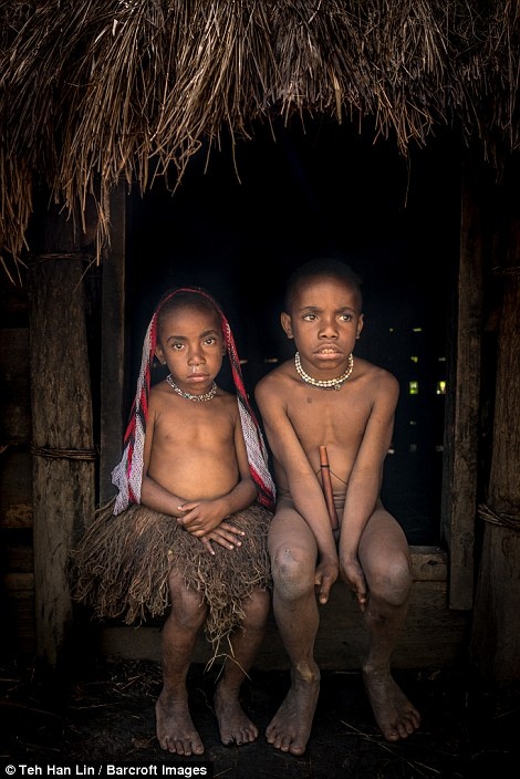 bo lac Dani chat ngon tay anh 6