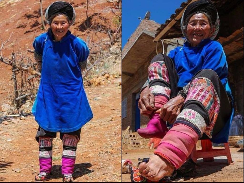 tục bó chân ở Trung Quốc ảnh 7 tuc bo chan o Trung Quoc anh 7