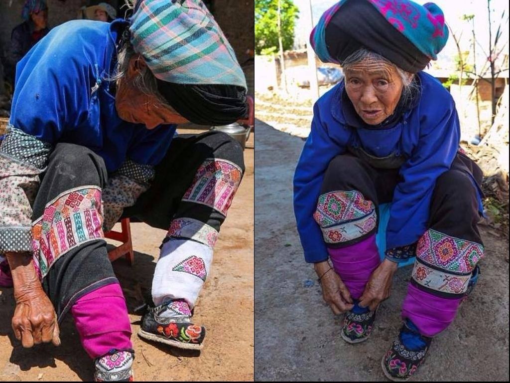 tục bó chân ở Trung Quốc ảnh 3 tuc bo chan o Trung Quoc anh 3