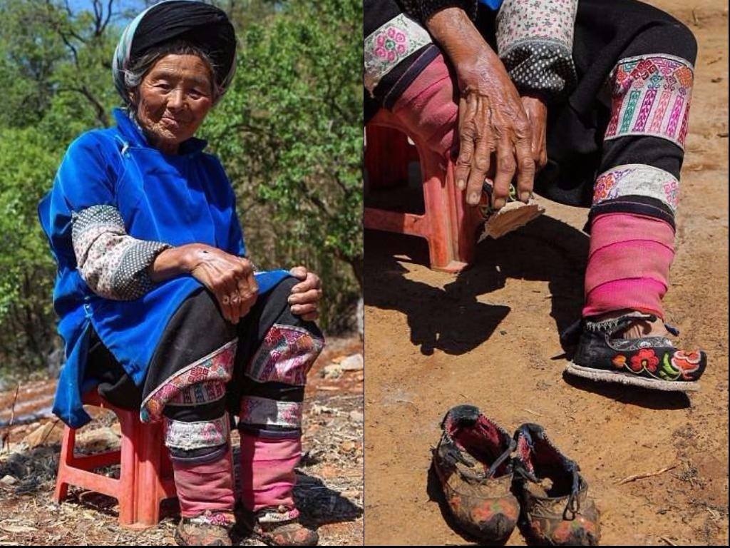 tục bó chân ở Trung Quốc ảnh 6 tuc bo chan o Trung Quoc anh 6