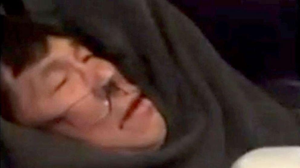 bác sĩ mỹ gốc việt bị kéo lê khỏi máy ảnh 1 bac si my goc viet bi keo le khoi may anh 1