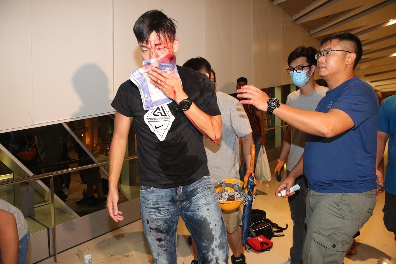 xa hoi den Hong Kong tan cong anh 3