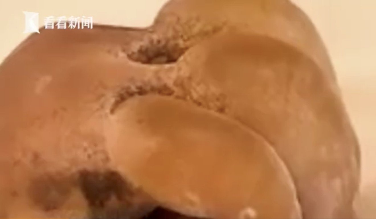 nu sinh trung quoc nguy co mat tay sau khi don tuyet anh 1