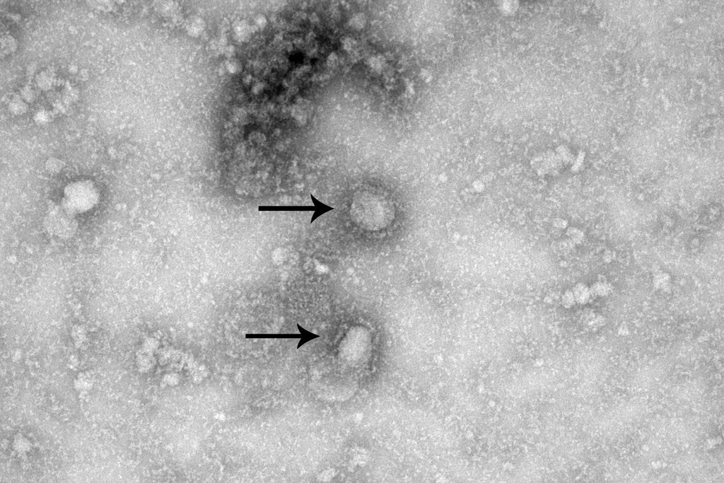 virus corona vu han anh 5