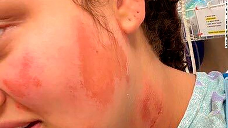 co gai da mau o my bi phong hoa anh 2