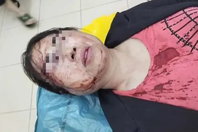 Chong danh vo Do Luong anh 2