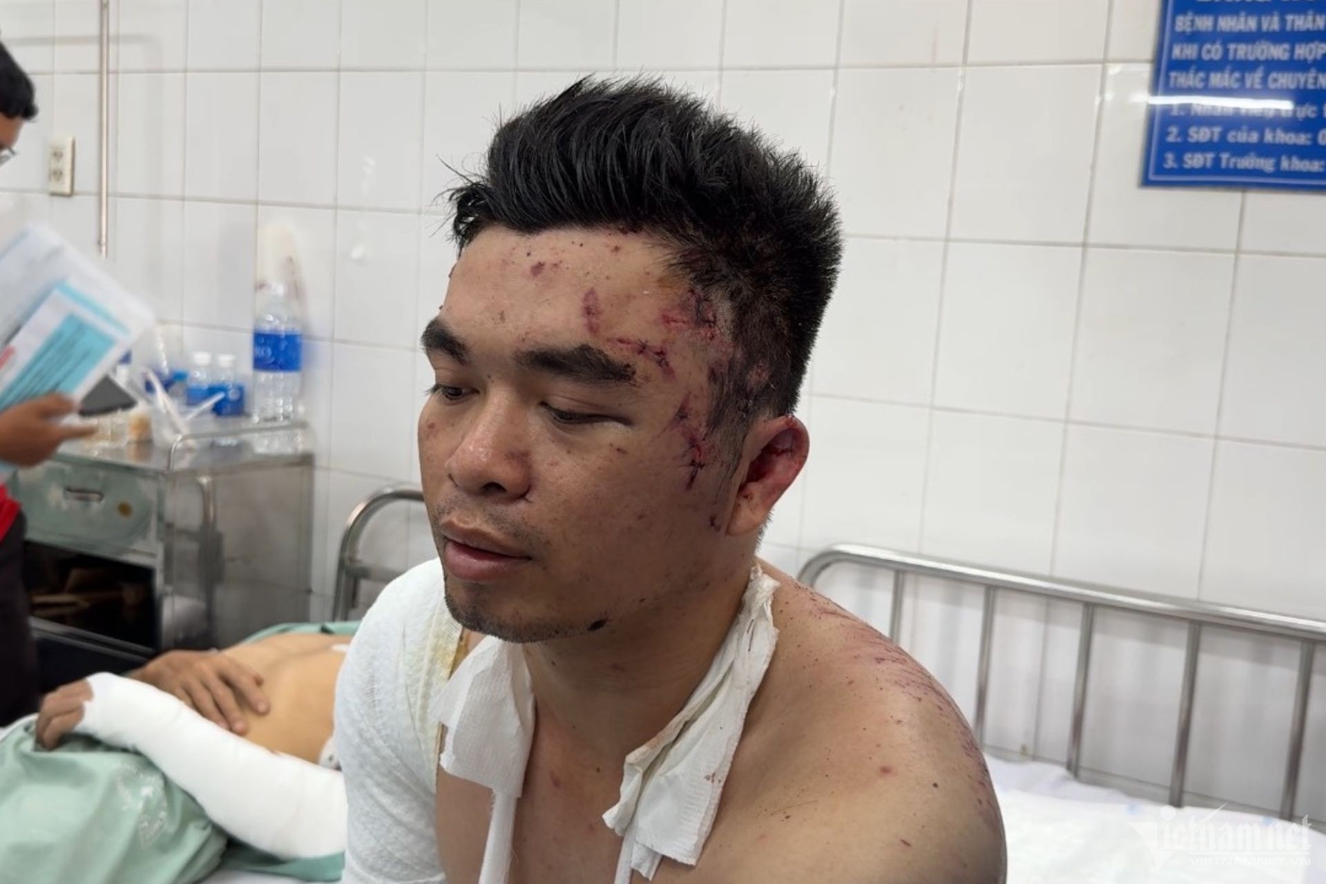 No lo hoi Dong Nai anh 4