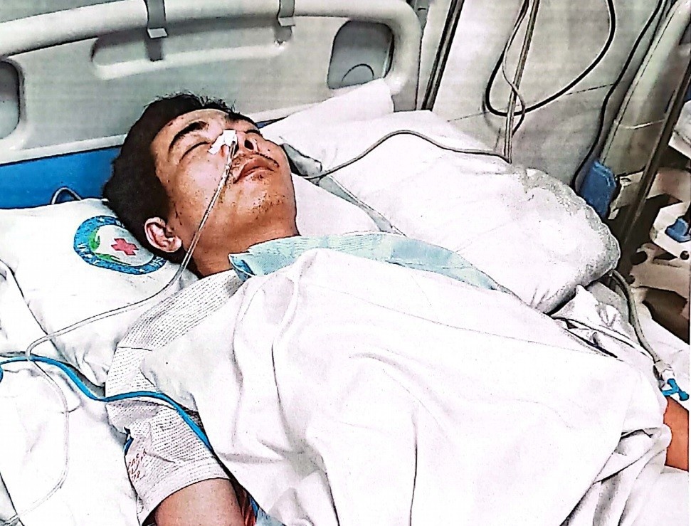 Sap xet xu doi tuong danh hang xom chan dong nao o Hung Yen hinh anh