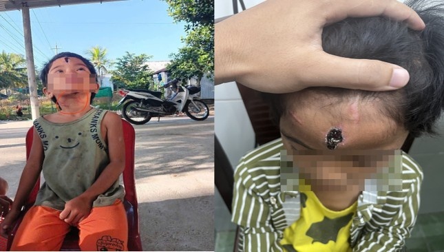 Nguyen Van Ly Kien Giang anh 1