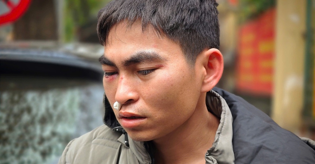 Vu shipper bi danh: Xu ly ke con do khong dung o 'boi thuong, xin loi' hinh anh