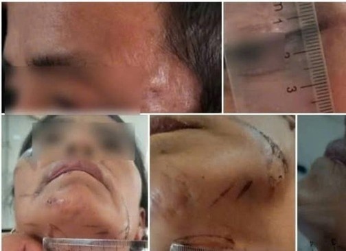 Bi danh, treo len cay do bi nghi lam bua khien nguoi khac tu vong hinh anh