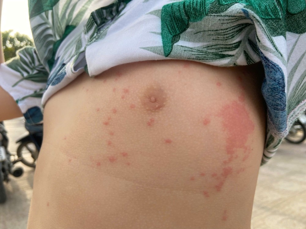 Sua lua Nha Trang anh 1