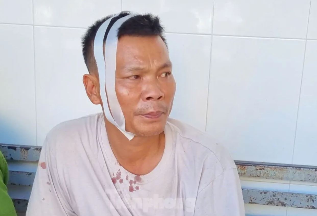 Tai nan cao toc anh 1