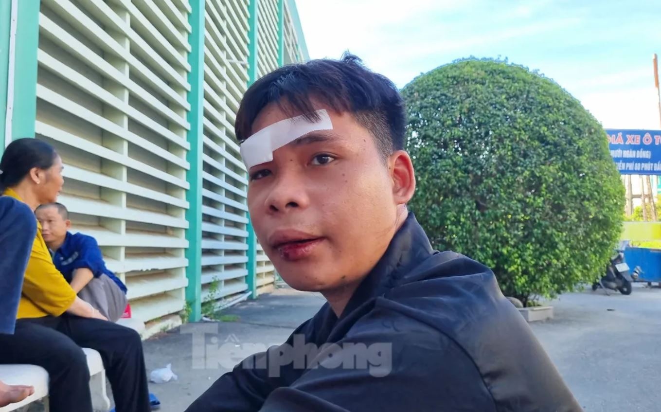 Tai nan cao toc anh 3