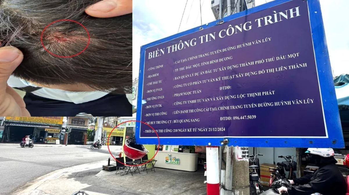 Nhieu nguoi di duong chay mau dau vi bang thong tin tren via he TP.HCM hinh anh