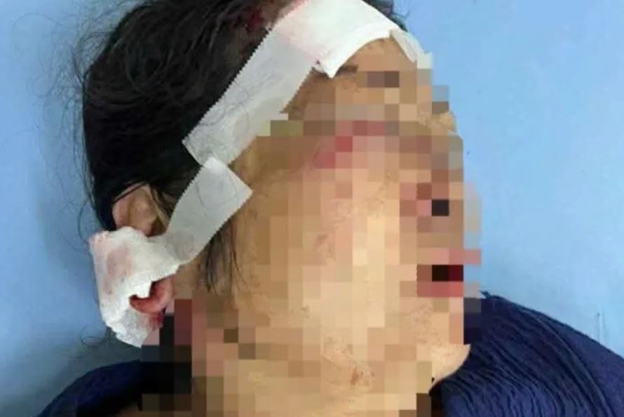 Phuc kich Da Lat anh 2