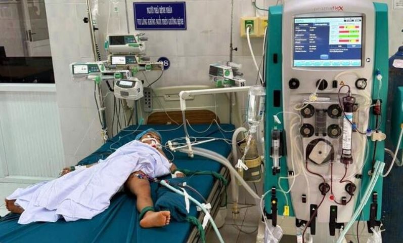 Bi 23 vet ong vo ve dot, be 5 tuoi o Gia Lai tu vong hinh anh