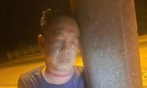 Nguoi dan ong nguy kich ben tru dien, tren co co vet thuong hinh anh