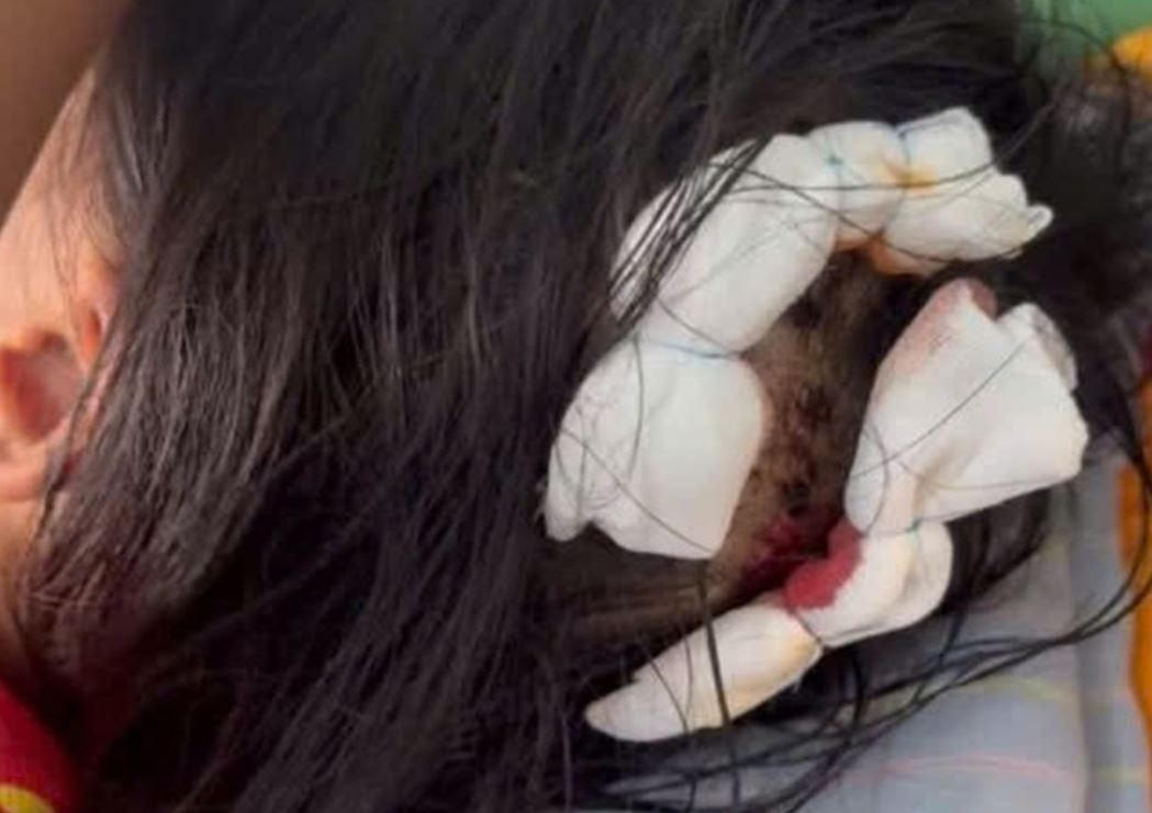 Tinh tiet moi vu be gai lop 5 bi cha duong bao hanh da man hinh anh