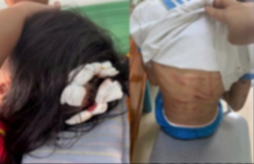 Bat khan cap cha duong dung bua dinh danh dap be gai 9 tuoi hinh anh