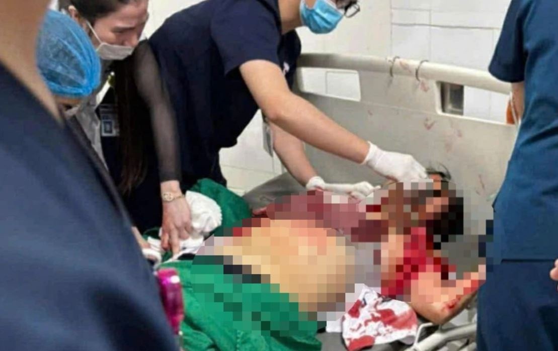 Nu dieu duong bi dam 11 nhat khi co gang ngan ke cam dao hinh anh