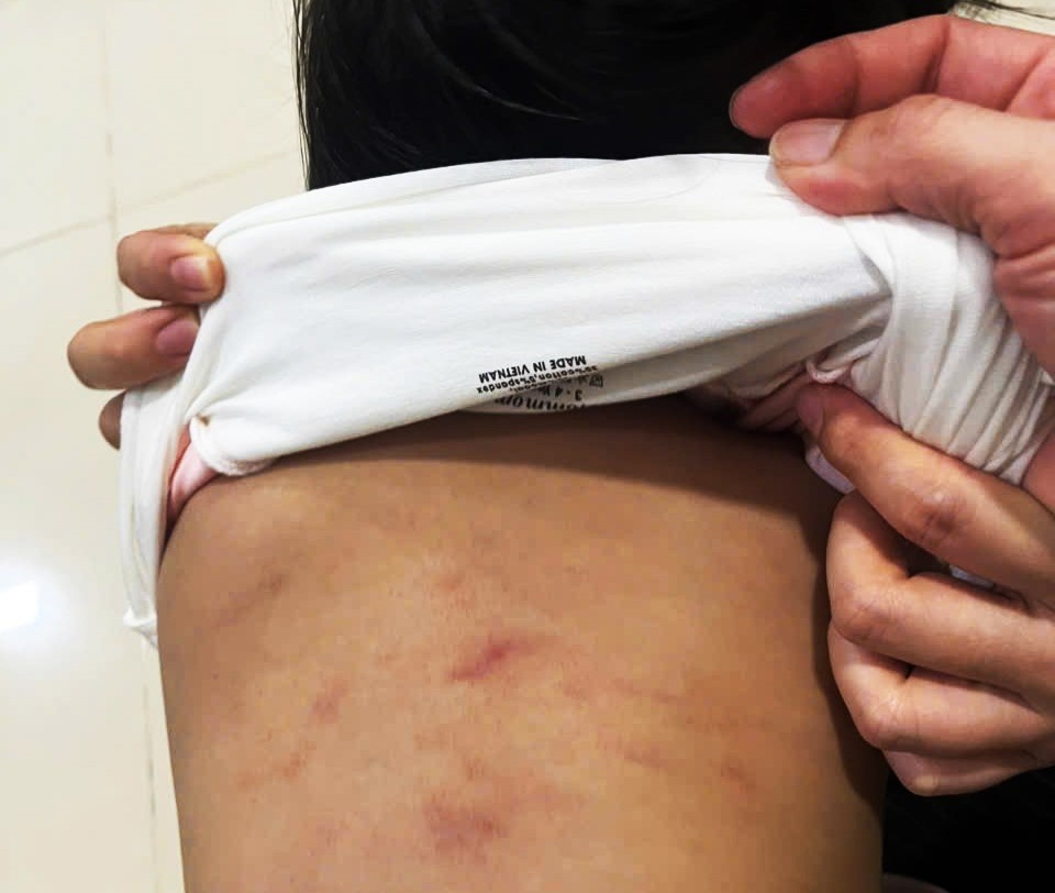 Bao hanh tre Ca Mau anh 1