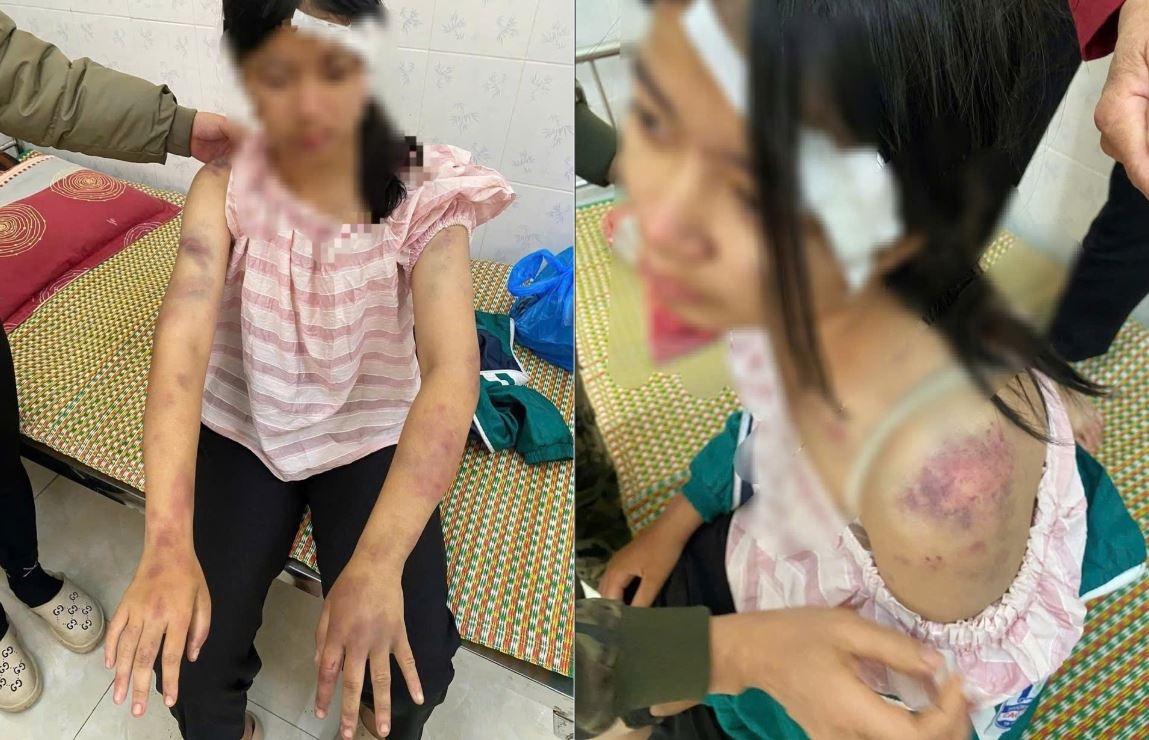 Hoan canh cua be gai 13 tuoi bi ba noi va hai nguoi dan ong danh dap hinh anh