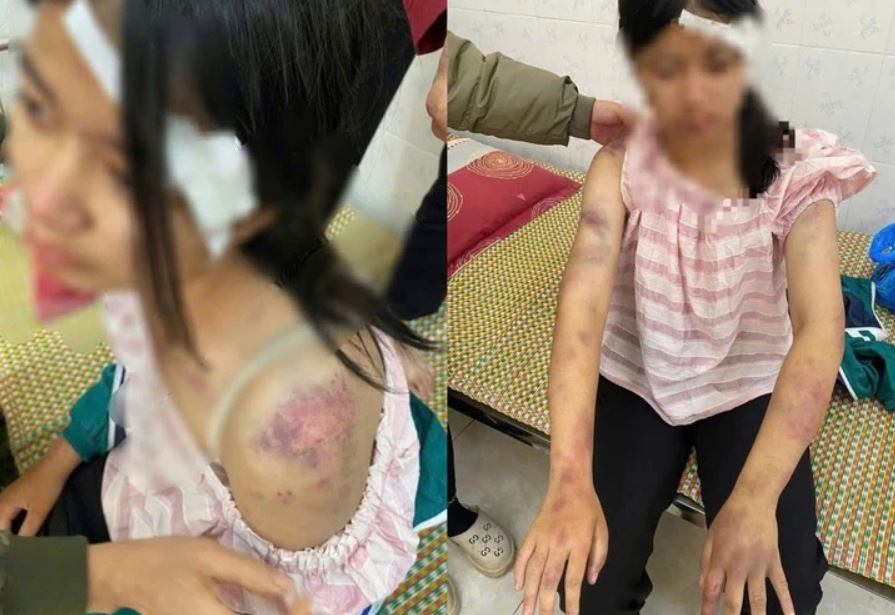 Ba ke tra tan chau gai co the bi khoi to them nhieu toi danh hinh anh