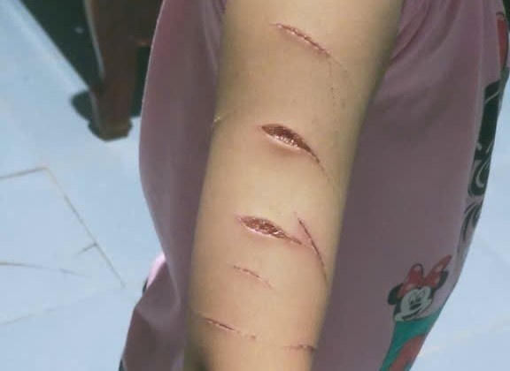 Cong an thong tin vu nu sinh lop 5 o Ca Mau bi rach tay hinh anh