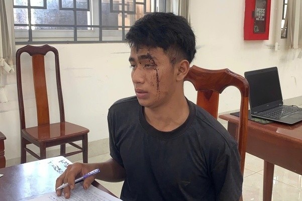 Tam giam thanh nien khong biet lai xe van trom oto, gay tai nan hinh anh