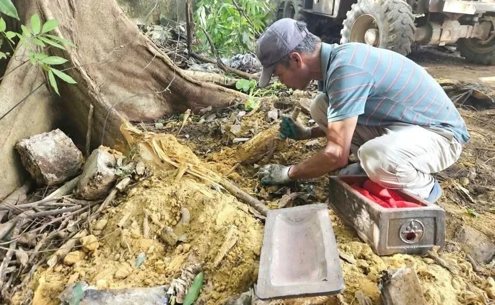 Phat hien gan 40 hai cot thai nhi khi mo duong hinh anh