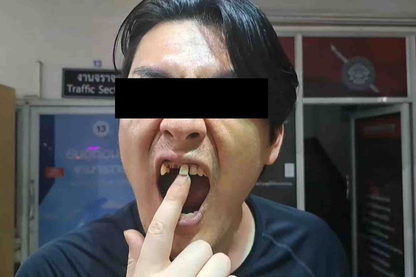 Du khach nem tien xuong dat, bi danh gay 3 rang tai Thai Lan hinh anh