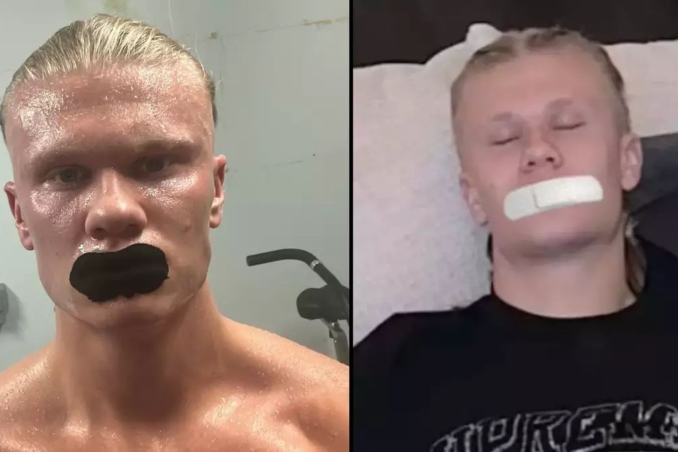 Su that ve trao luu dan mieng khi ngu cua Erling Haaland hinh anh