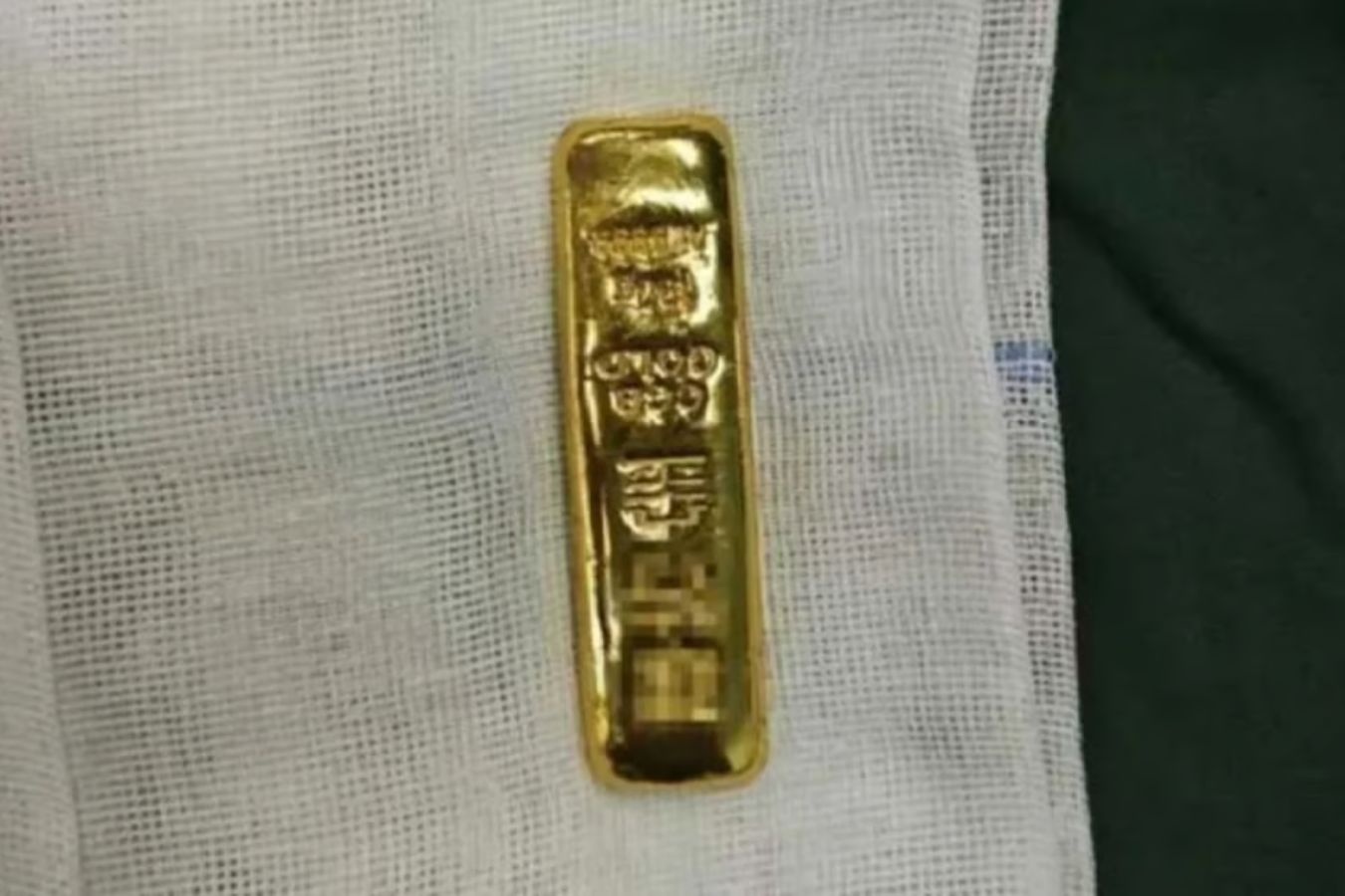 Be trai Trung Quoc thay bung bi sung, hoa ra da nuot 26 chi vang hinh anh