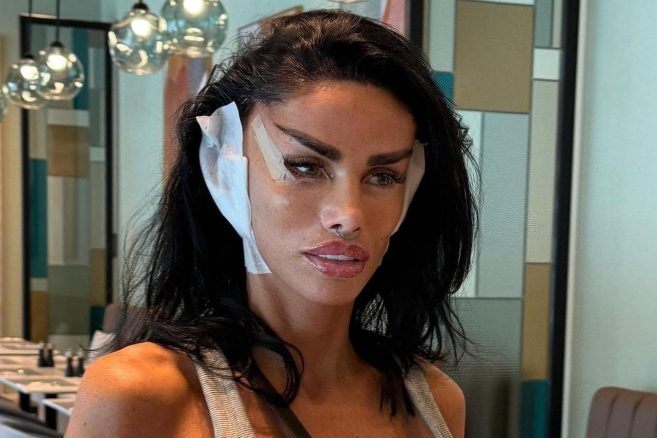 Ve ngoai gay soc cua cuu mau Anh sau phau thuat tham my hinh anh