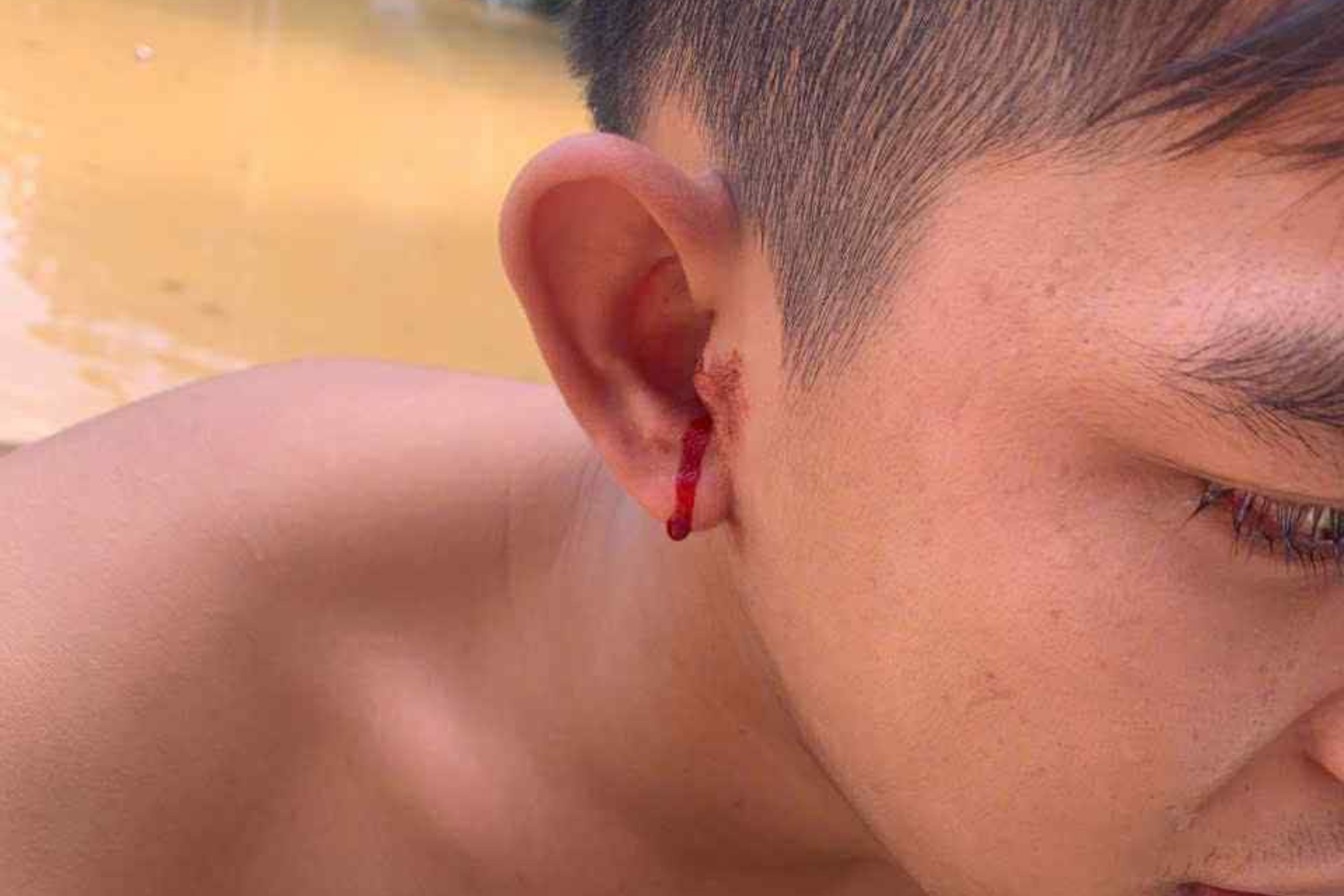 Dau dieng nguoi vi ret chui vao tai khi chay lu o Thai Nguyen hinh anh