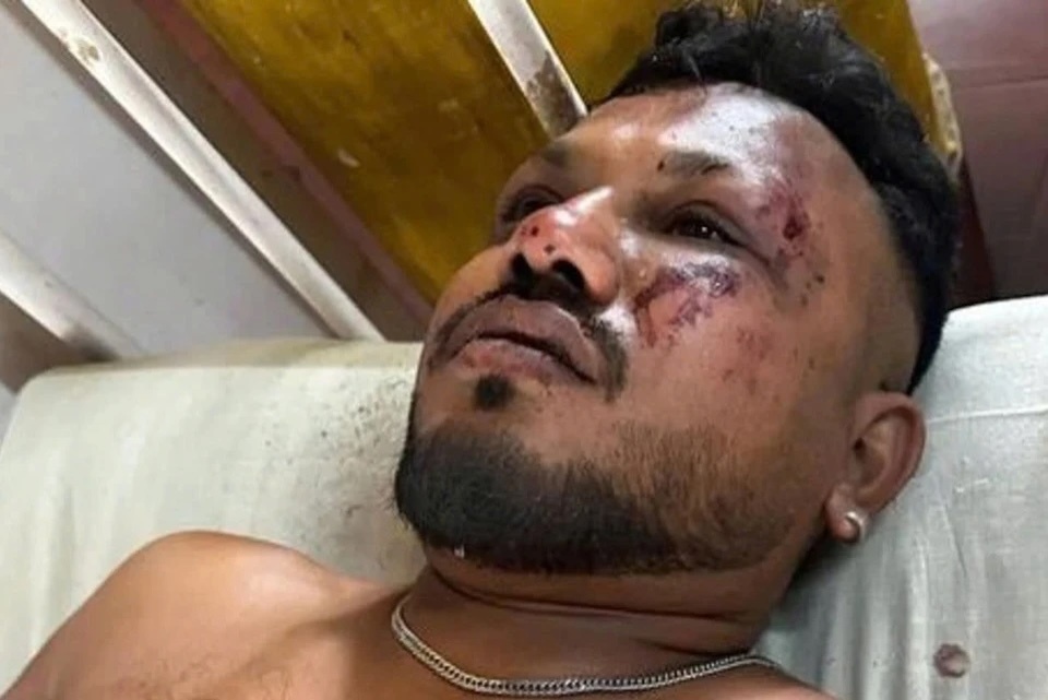 Nguoi song sot duy nhat trong vu roi may bay Air India keu cuu hinh anh