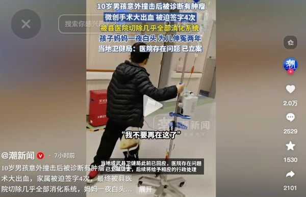 be trai mat noi tang anh 1