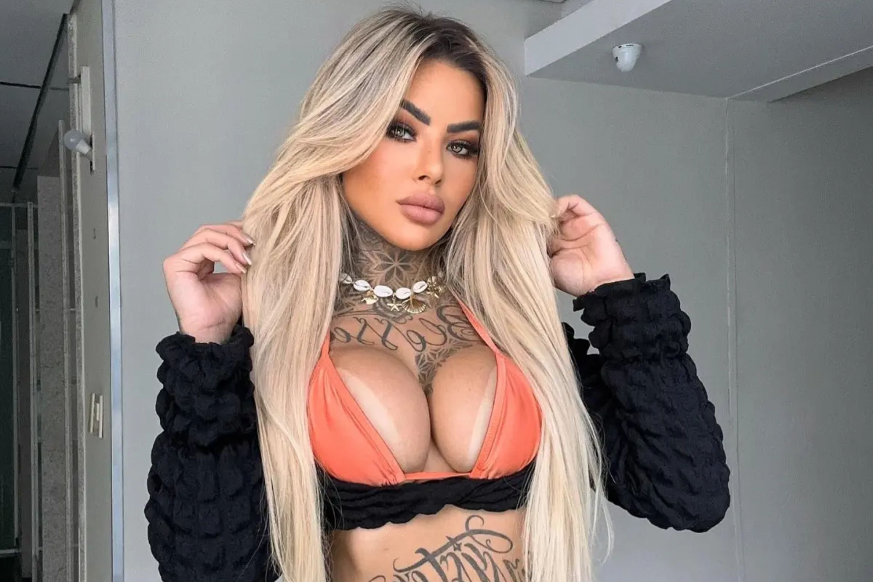 Sao mang tu vong sau ca phau thuat tham my lon hinh anh