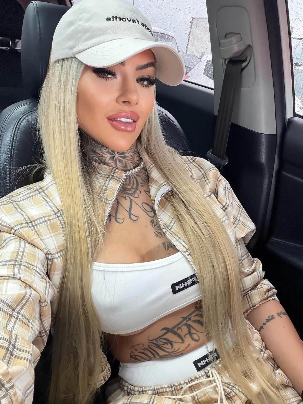 phau thuat tham my anh 1