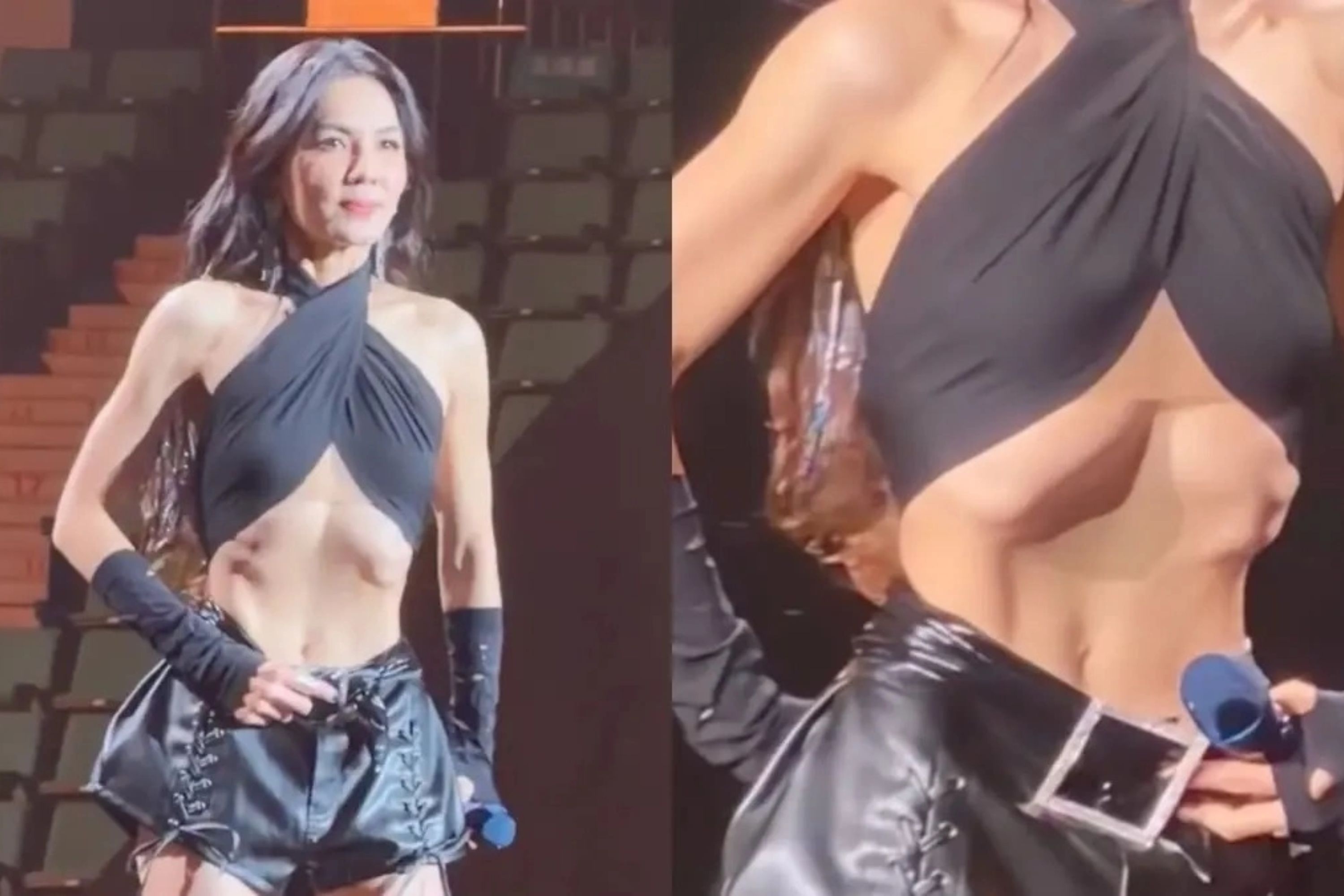 Co bung 'bien dang' cua ca si Dai Loan gay tranh cai hinh anh