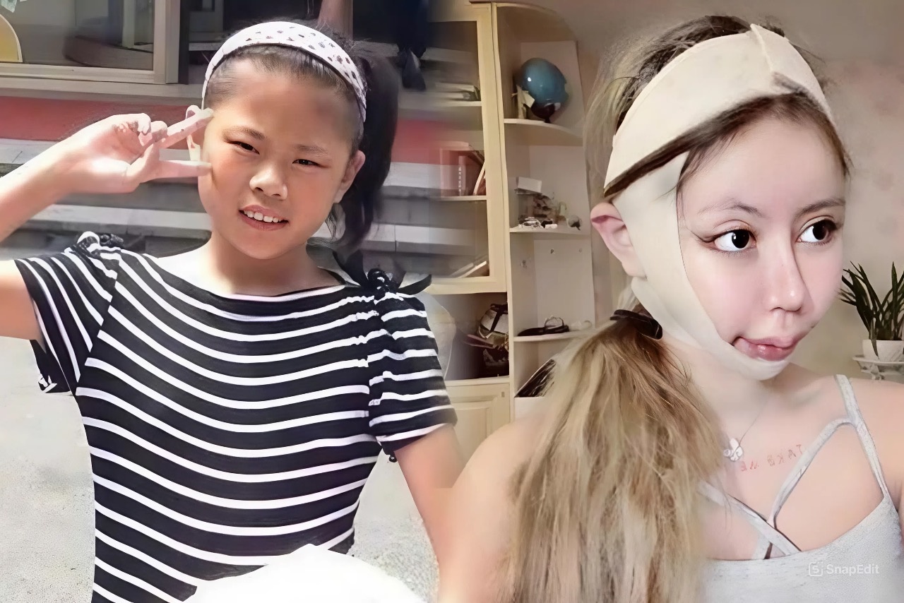 Co gai 18 tuoi 'dao keo' hon 100 lan gio ra sao? hinh anh