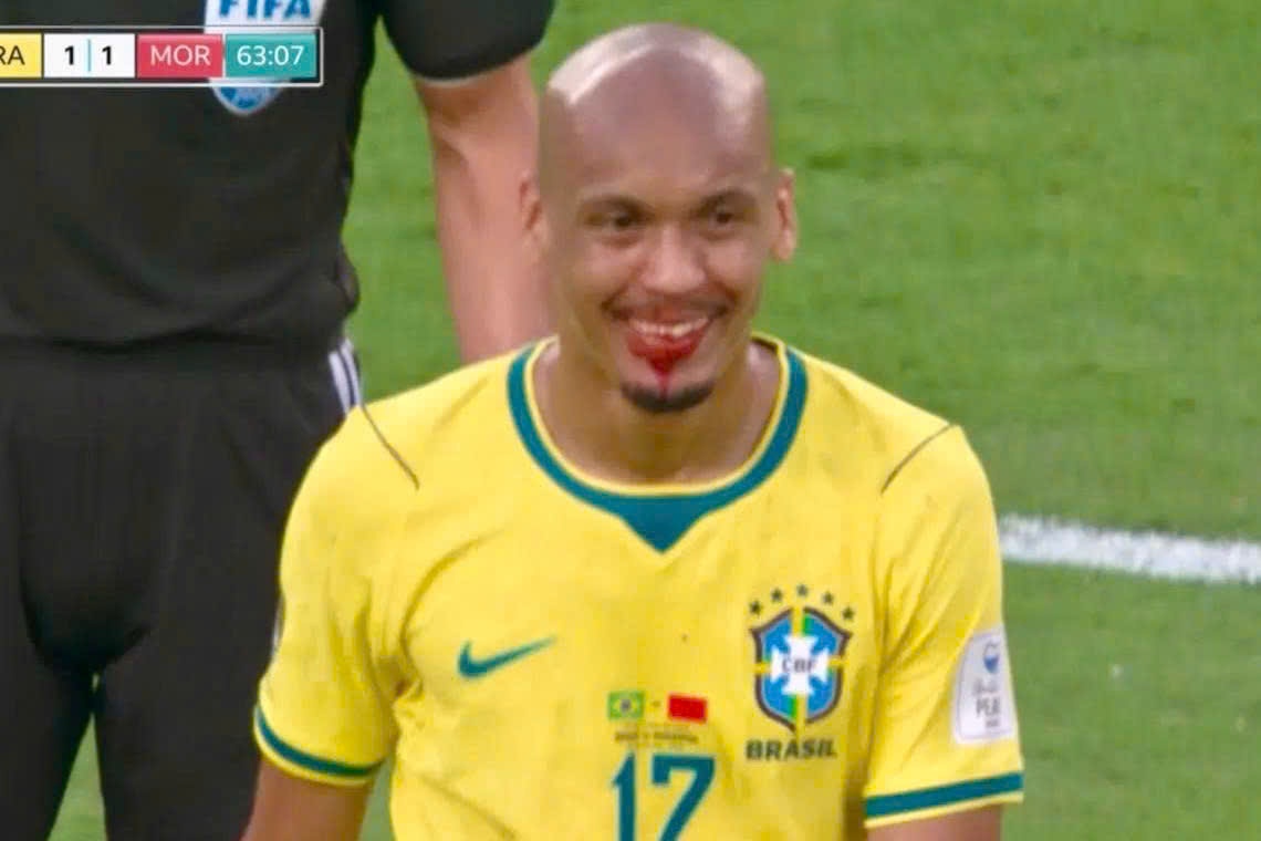 Nu cuoi 'ma ca rong' cua cau thu Brazil viral khap coi mang hinh anh