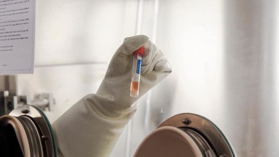 Trung Quoc bac tin kit xet nghiem tang Philippines chat luong kem hinh anh