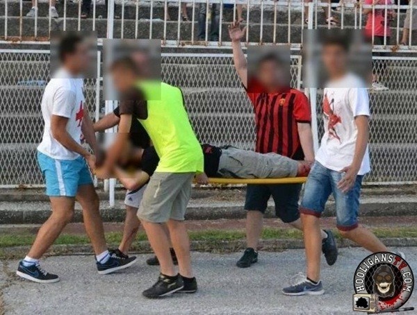 Co dong vien dut lia ban tay vi dung do canh sat hinh anh