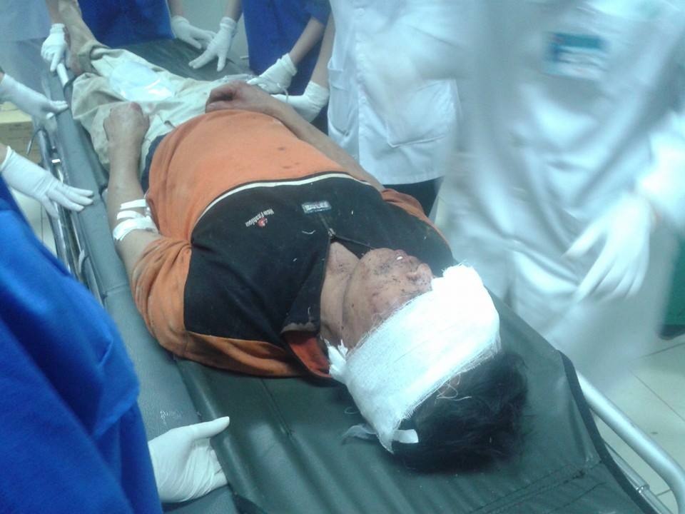 Anh Phan Văn Xô (1972) - một nạn nhân trong vụ sập giàn giáo.  Ảnh: P.H