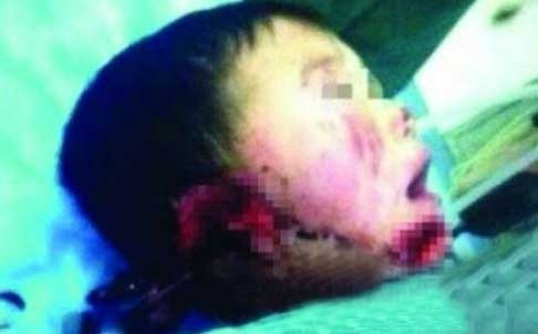 Cat tai be 6 tuoi vi mau thuan gia dinh hinh anh