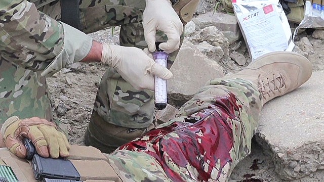 Bo dung cu cam mau sieu toc ra doi tu phuong phap va lop hinh anh