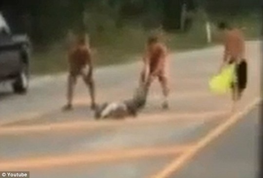 Mui long truoc ca sau, chang trai phai khau 80 mui hinh anh