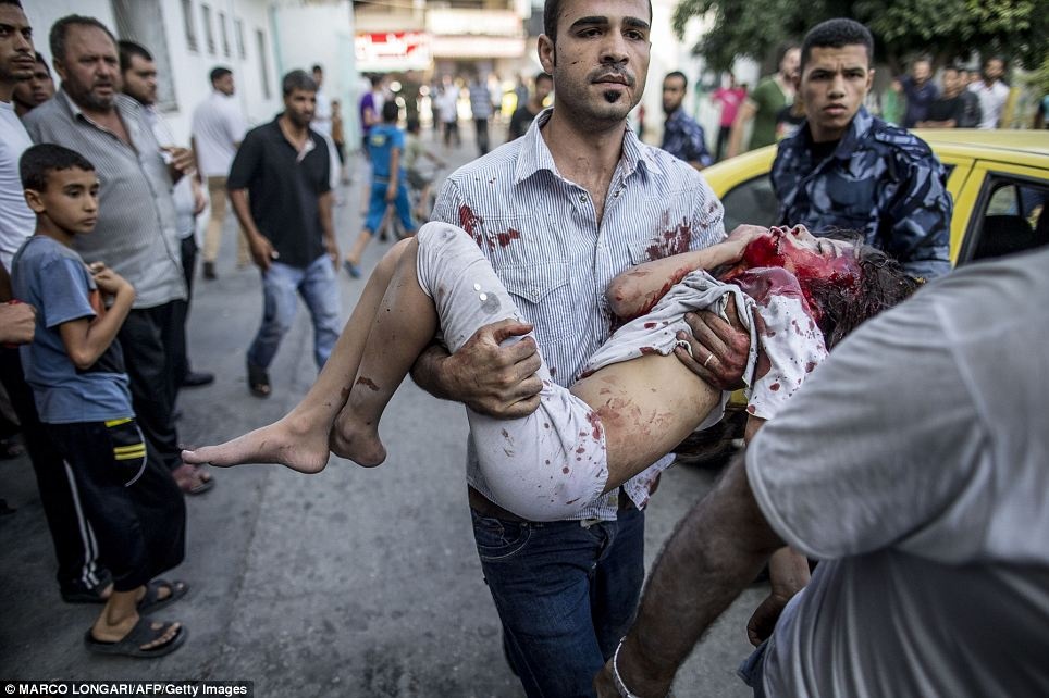 Hon 100 nguoi chet vi bom dan Israel trong 1 ngay qua hinh anh